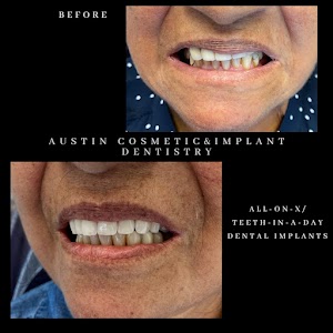 Austin Cosmetic & Implant Dentistry