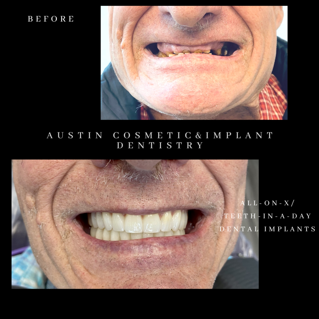 Austin Cosmetic & Implant Dentistry