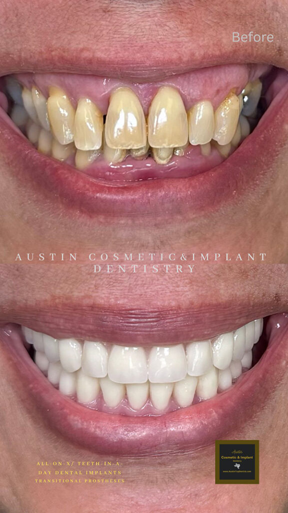 eviton-20-Amp-Decora-Tamper-Resistant-Duplex-Electrical-Wall-Outlet