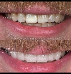 Austin Cosmetic & Implant Dentistry place picture